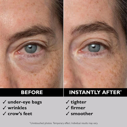 Instant FIRMx Temporary Eye Tightener