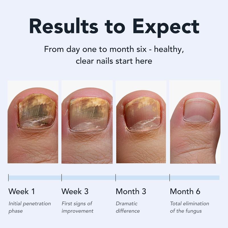 ToeNail Fungus Repair Pen