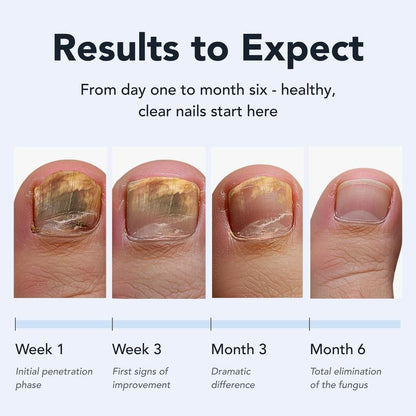 ToeNail Fungus Repair Pen