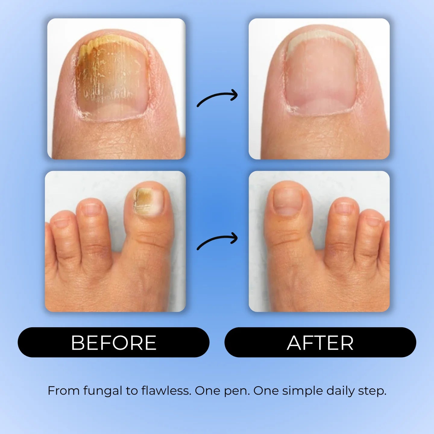 ToeNail Fungus Repair Pen