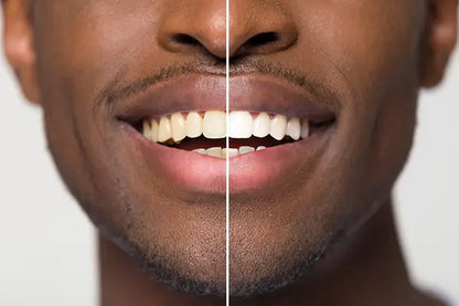 PalmWHITE™ - Teeth Brightening Powder Instant Brightening