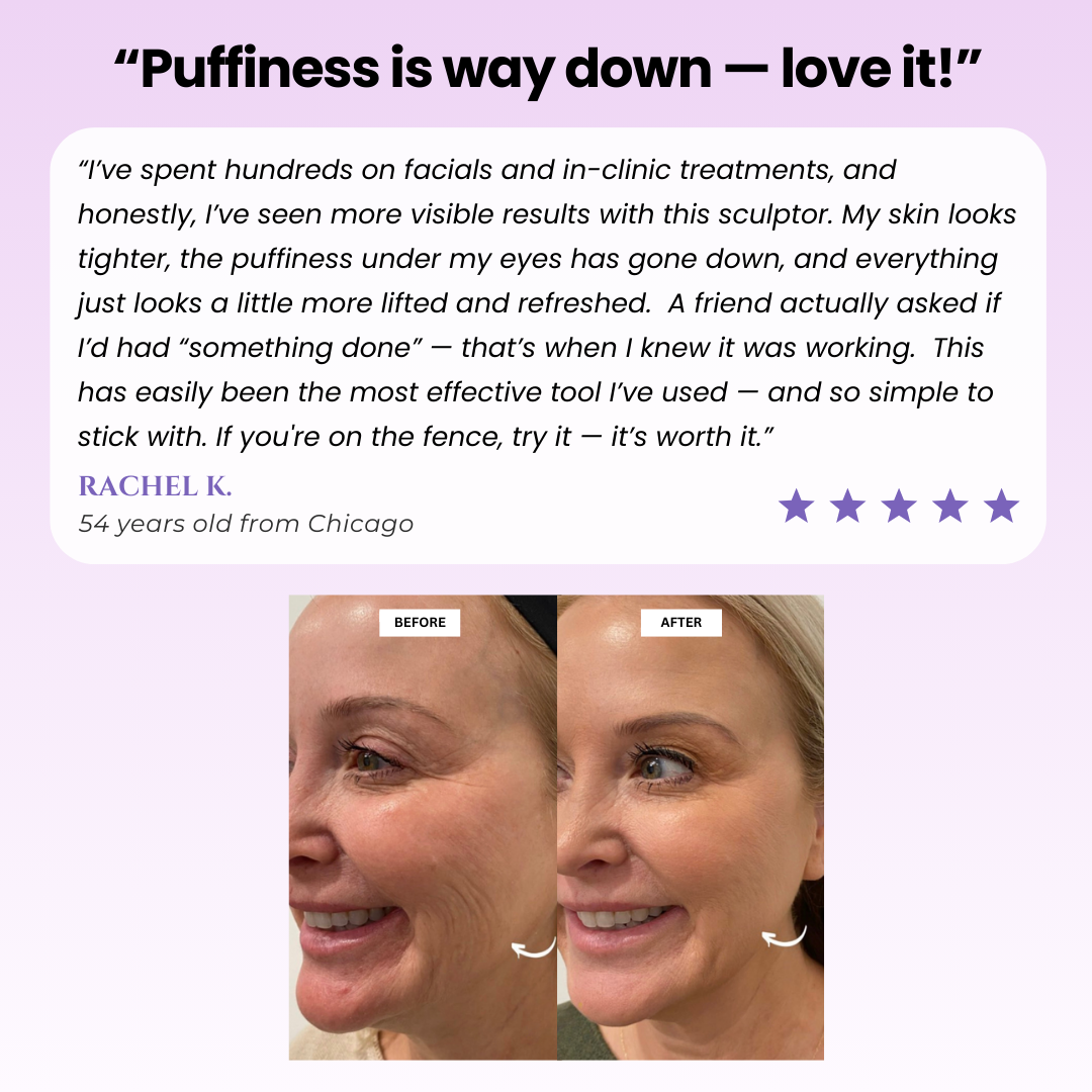 GlowLift Skin™ - Uplift Massaging Beauty Roller