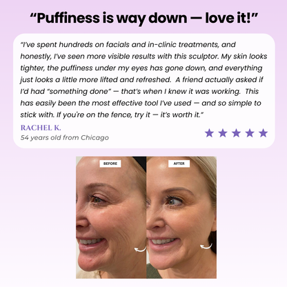 GlowLift Skin™ - Uplift Massaging Beauty Roller