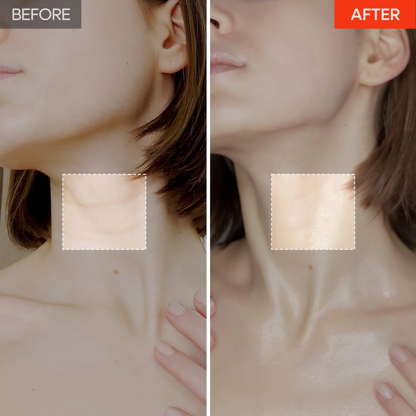 DermaLift™ - Advanced 3-minutes Neck Wrinkle Repair Trio