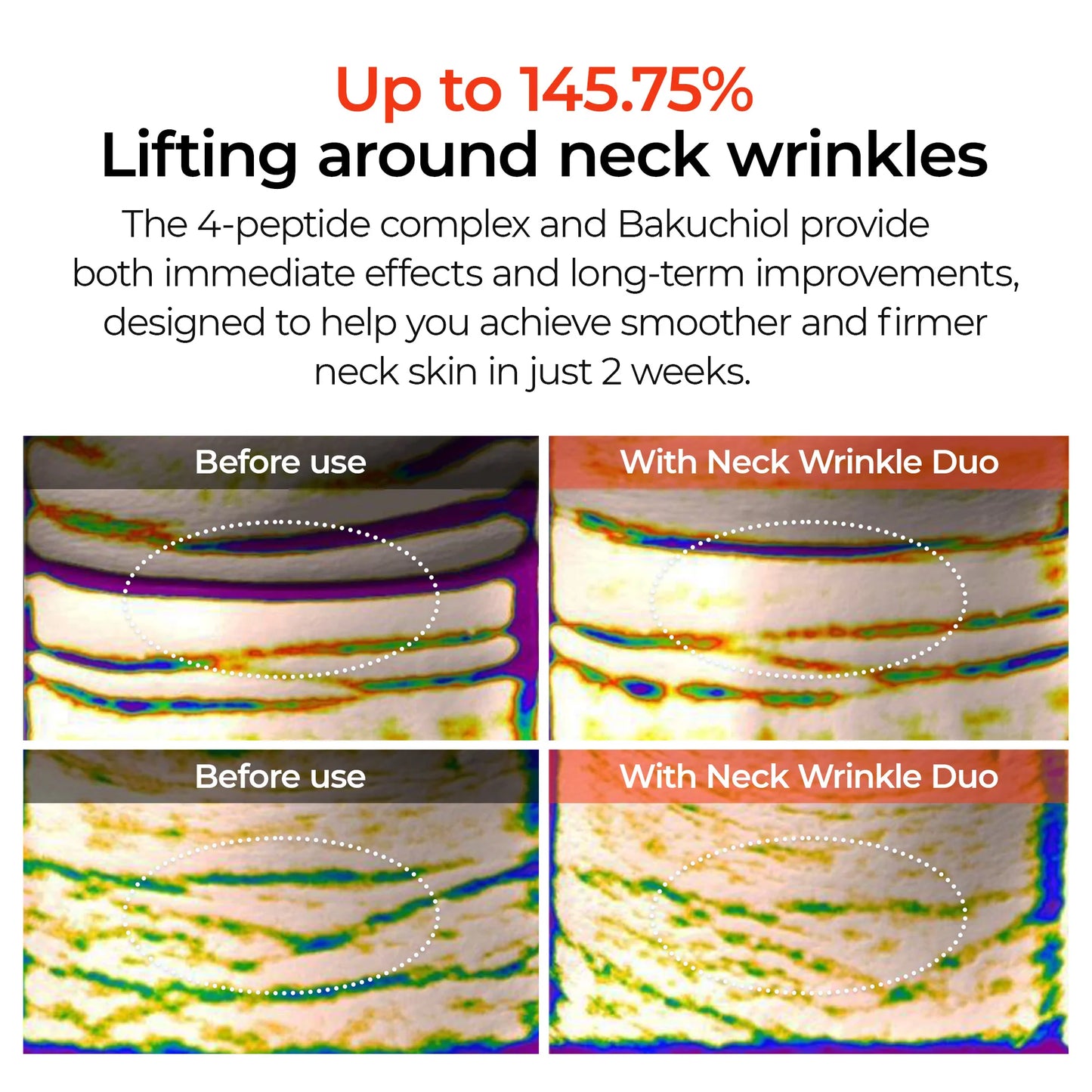 DermaLift™ - Advanced 3-minutes Neck Wrinkle Repair Trio