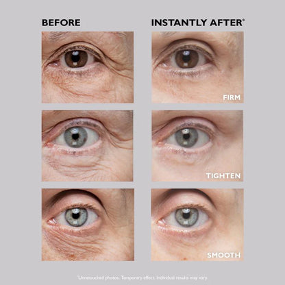 Instant FIRMx Temporary Eye Tightener