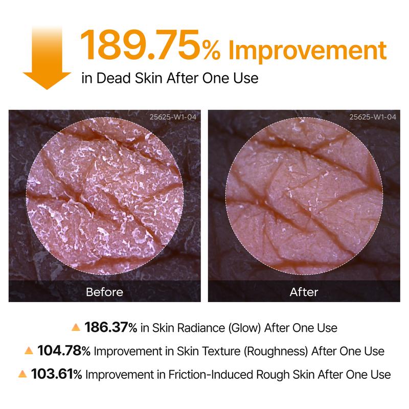 Peel Shot Keratin Care Kojic Acid Turmeric Spray + FREE GIFTS