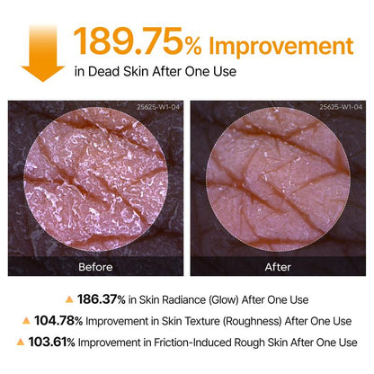 Peel Shot Keratin Care Kojic Acid Turmeric Spray + FREE GIFTS