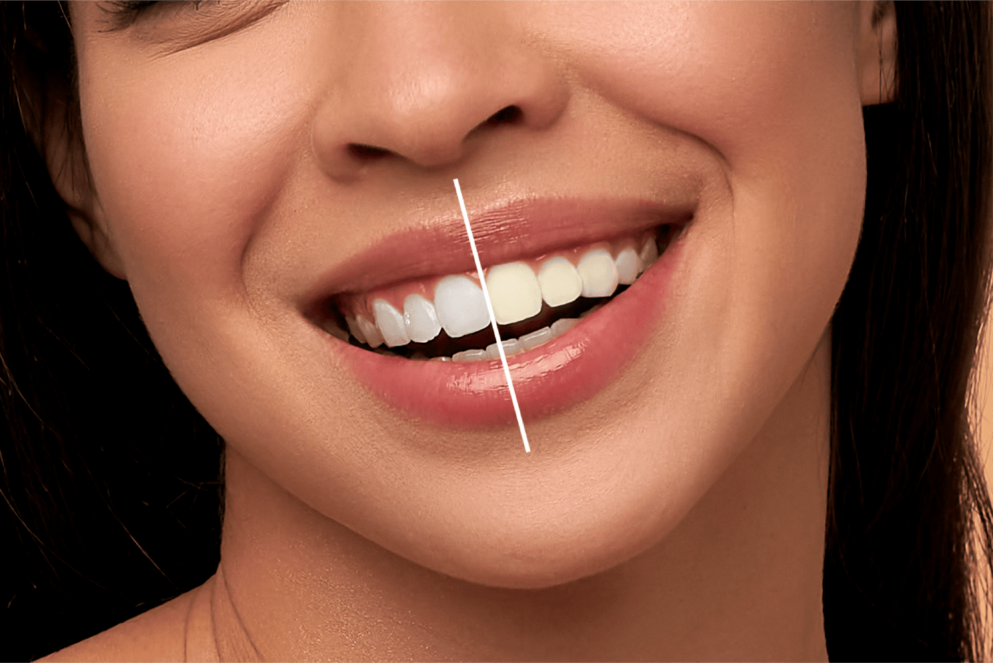 PalmWHITE™ - Teeth Brightening Powder Instant Brightening