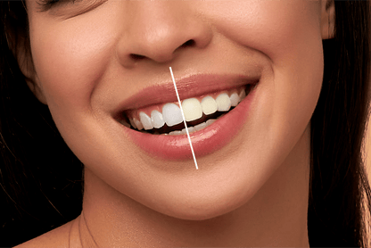 PalmWHITE™ - Teeth Brightening Powder Instant Brightening