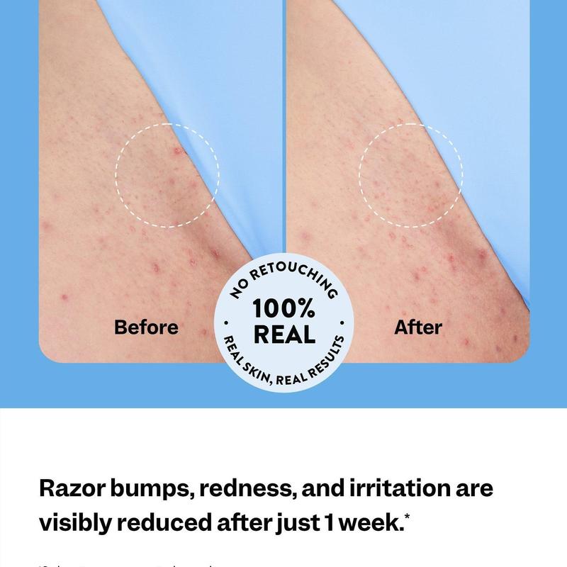 PeachSmooth™ – Roll-On Serum for Ingrown Hair & Razor Bumps