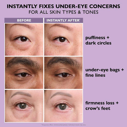 Instant FIRMx Temporary Eye Tightener