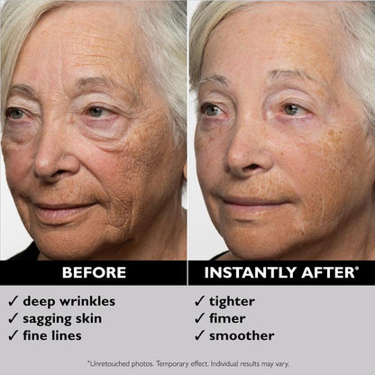 Instant FIRMx Temporary Eye Tightener
